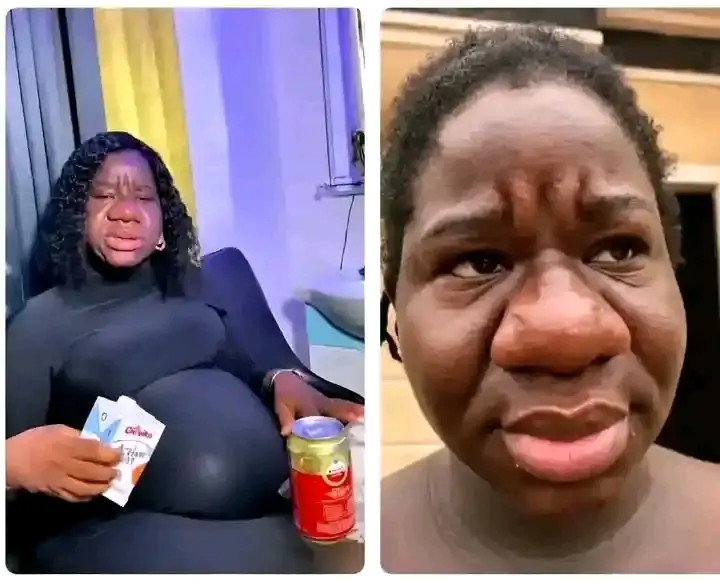Pregnant Woman Whose Nose Became Noticeably Bigger During Pregnancy Reportedly Dies at 26