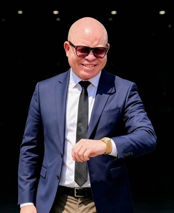 John Chiti Launches Zambia’s First Miss Albinism Reality Show.