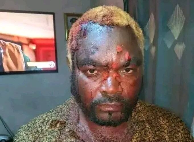Zambia : General Kanene Hospitalised After Machete Attack At Rally