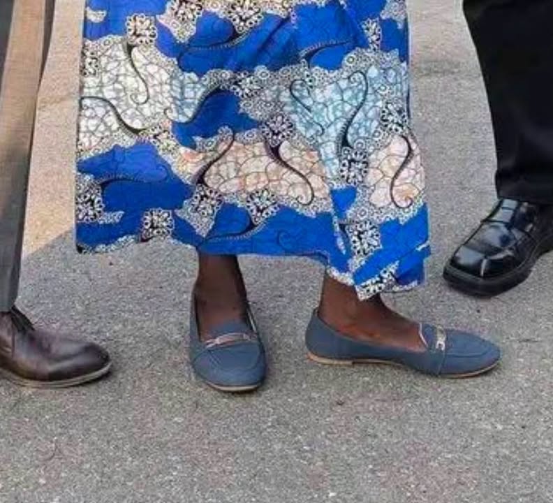 The legs that waked 857km from Mwinilunga to lusaka.Very fit, Not swollen at all.