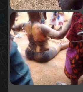 Woman Accused of Witchcraft and Set Ablaze By Son Passes Away in Calabar Cross River State