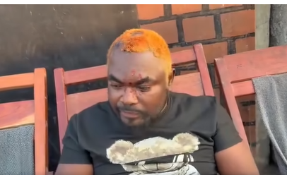 I almost died – Zambian musician General Kanene recounts brutal attack by UPND cadresin Mwembeshi