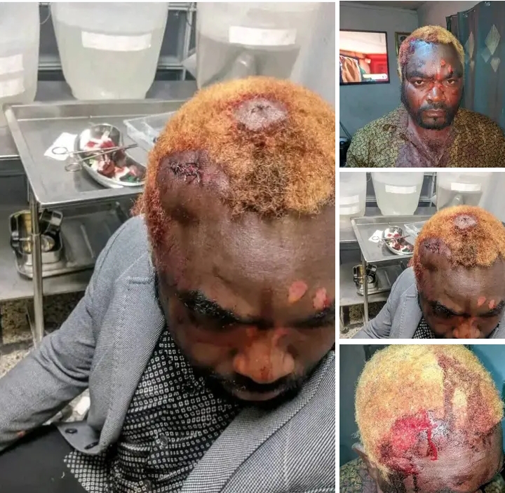 General Kanene not dead, admitted to UTH – Police