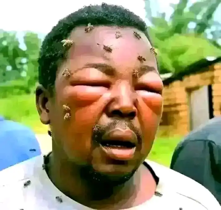 Bees Attack Monze Pastor For Sleeping With Someone’s wife